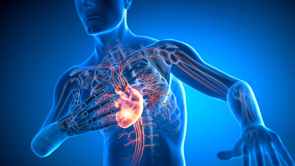 Infarto | Cardioexame